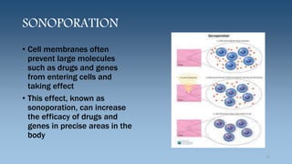 SONOPORATION
• Cell membranes often
prevent large molecules
such as drugs and genes
from entering cells and
taking effect
• This effect, known as
sonoporation, can increase
the efficacy of drugs and
genes in precise areas in the
body
13
 