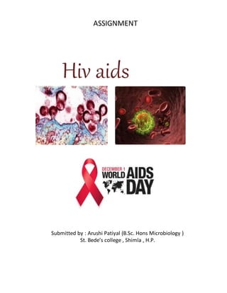 ASSIGNMENT
Hiv aids
Submitted by : Arushi Patiyal (B.Sc. Hons Microbiology )
St. Bede’s college , Shimla , H.P.
 