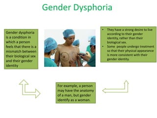Gender Dysphoria
What is gender Dysphoria?
                                                   •   They have a strong desire to live
Gender dysphoria                                       according to their gender
is a condition in                                      identity, rather than their
which a person                                         biological sex.
feels that there is a                              •   Some people undergo treatment
mismatch between                                       so that their physical appearance
their biological sex                                   is more consistent with their
                                                       gender identity.
and their gender
identity




                           For example, a person
                           may have the anatomy
                           of a man, but gender
                           identify as a woman.
 