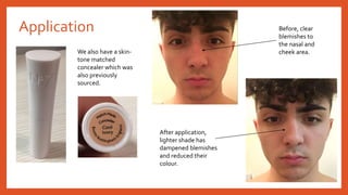 Application
We also have a skin-
tone matched
concealer which was
also previously
sourced.
Before, clear
blemishes to
the nasal and
cheek area.
After application,
lighter shade has
dampened blemishes
and reduced their
colour.
 