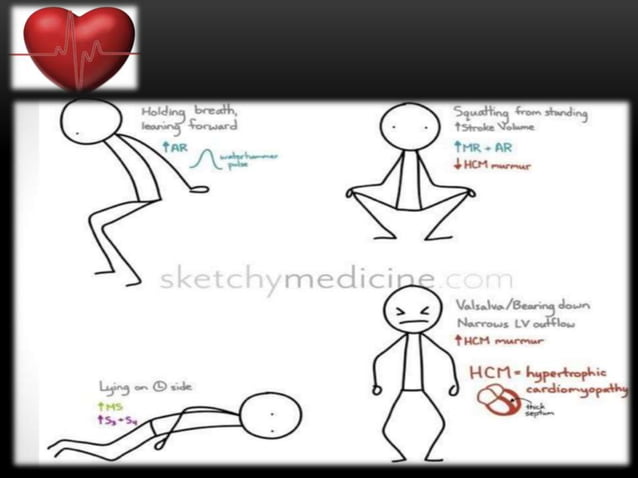 Heart Sounds And Murmurs Ppt