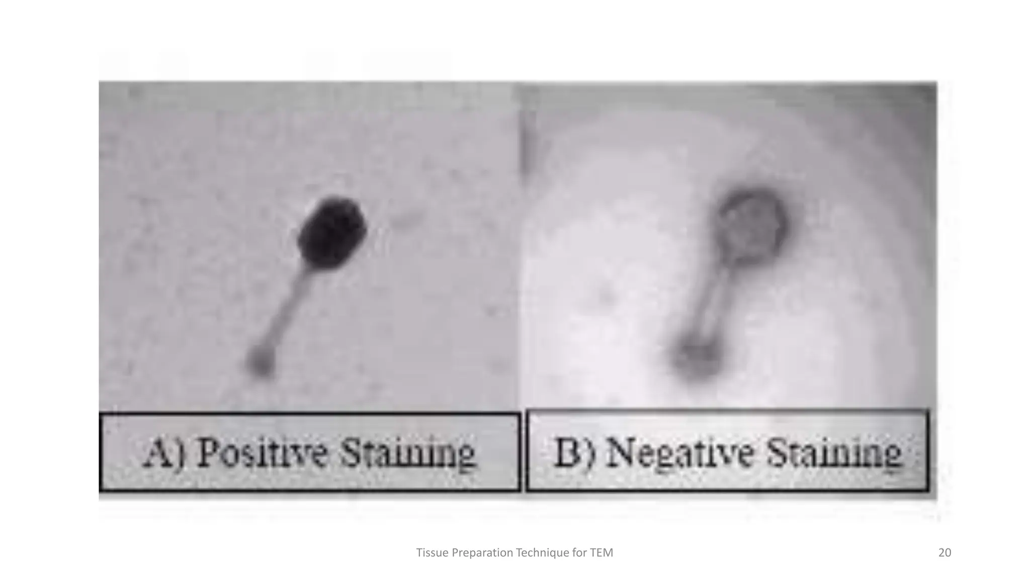 Tissue Preparation Technique for TEM 20
 