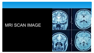 MRI SCAN IMAGE
 