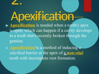 ASSIGNMENT ON APEXOGENESIS AND APEXIFICATION.pptx