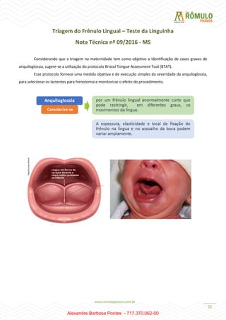 22
Triagem do Frênulo Lingual – Teste da Linguinha
Nota Técnica nº 09/2016 - MS
Considerando que a triagem na maternidade tem como objetivo a identificação de casos graves de
anquiloglossia, sugere-se a utilização do protocolo Bristol Tongue Assessment Tool (BTAT).
Esse protocolo fornece uma medida objetiva e de execução simples da severidade da anquiloglossia,
para selecionar os lactentes para frenotomia e monitorizar o efeito do procedimento.
Alexandre Barbosa Pontes - 717.370.062-00
 