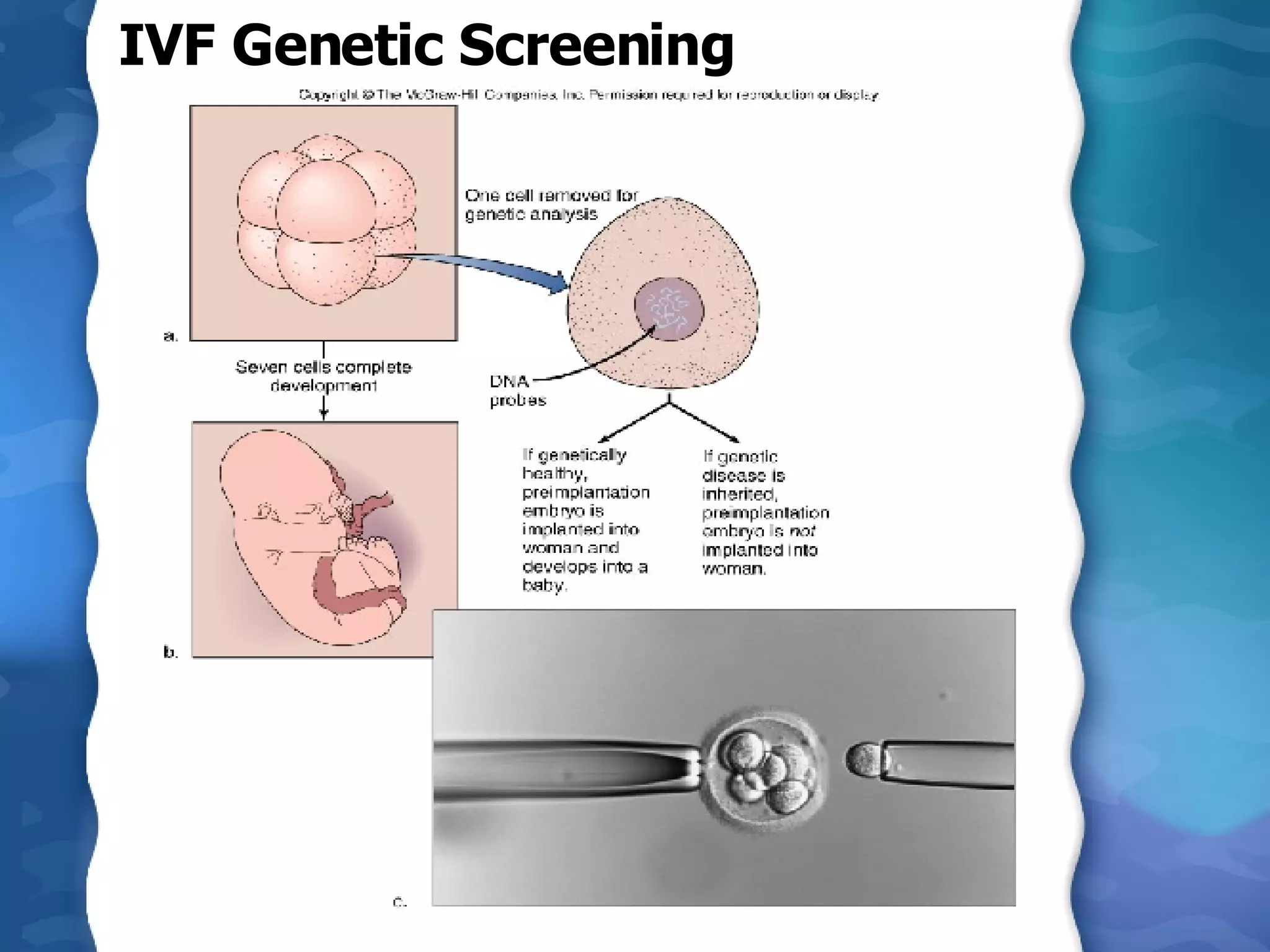 IVF Genetic Screening  