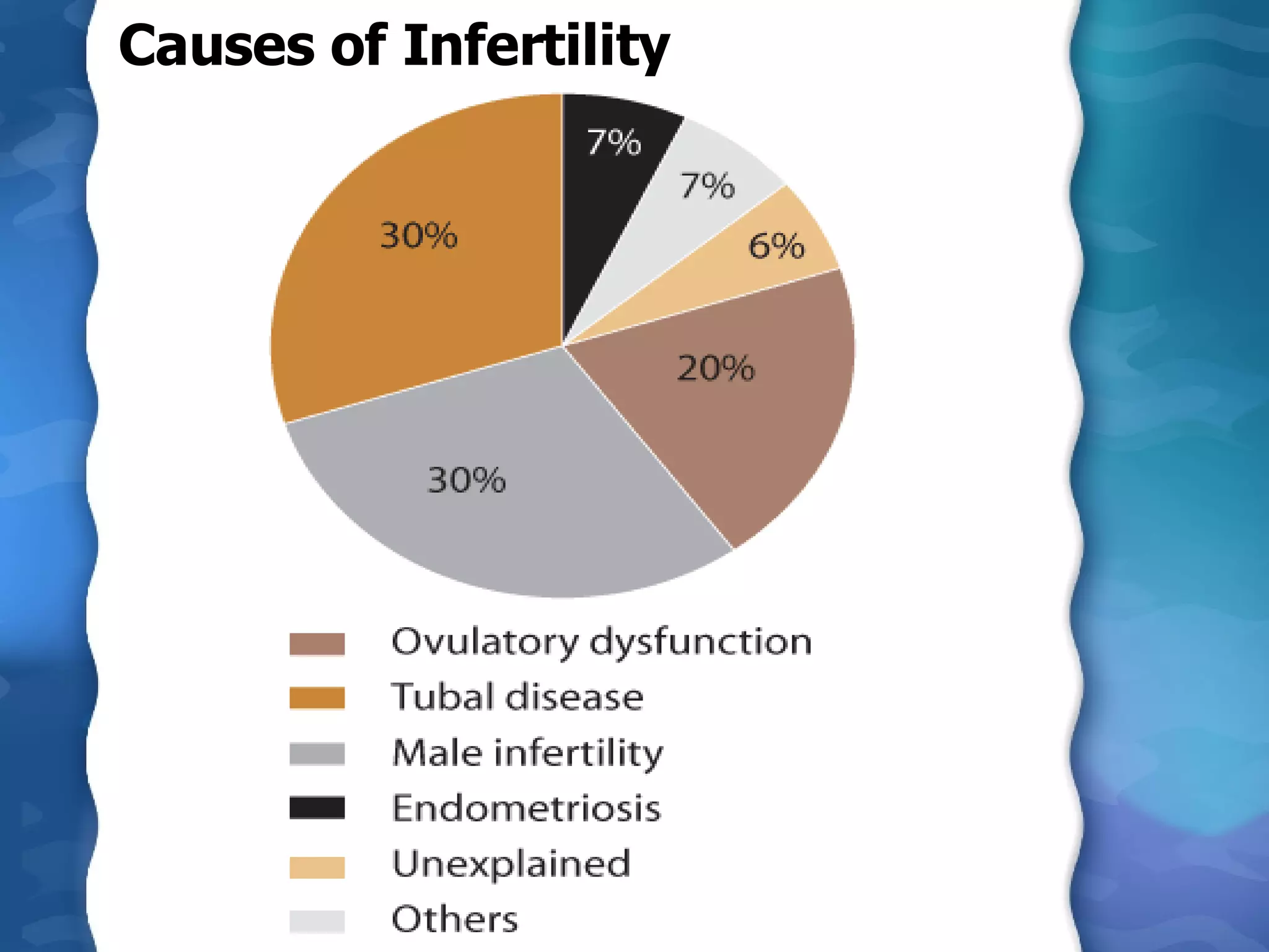 Causes of Infertility 