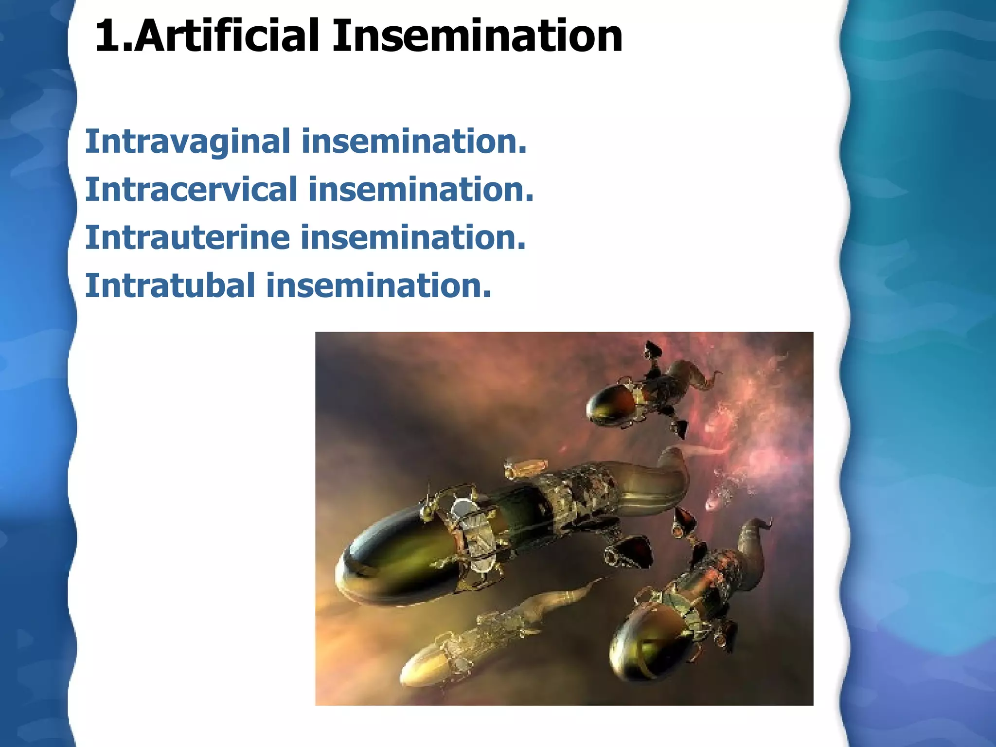 1.Artificial Insemination Intravaginal insemination. Intracervical insemination. Intrauterine insemination. Intratubal insemination. 