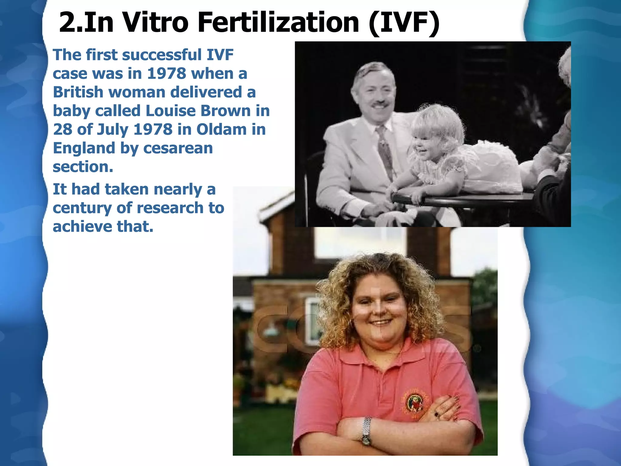 2.In Vitro Fertilization (IVF) The first successful IVF case was in 1978 when a British woman delivered a baby called Louise Brown in 28 of July 1978 in Oldam in England by cesarean section.  It had taken nearly a century of research to achieve that.  