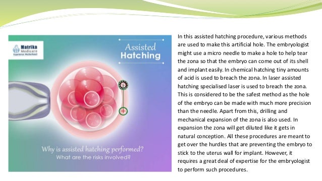 Assisted Hatching