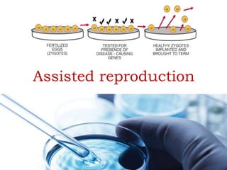 Assisted reproduction
 