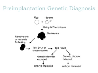 Preimplantation Genetic Diagnosis
 