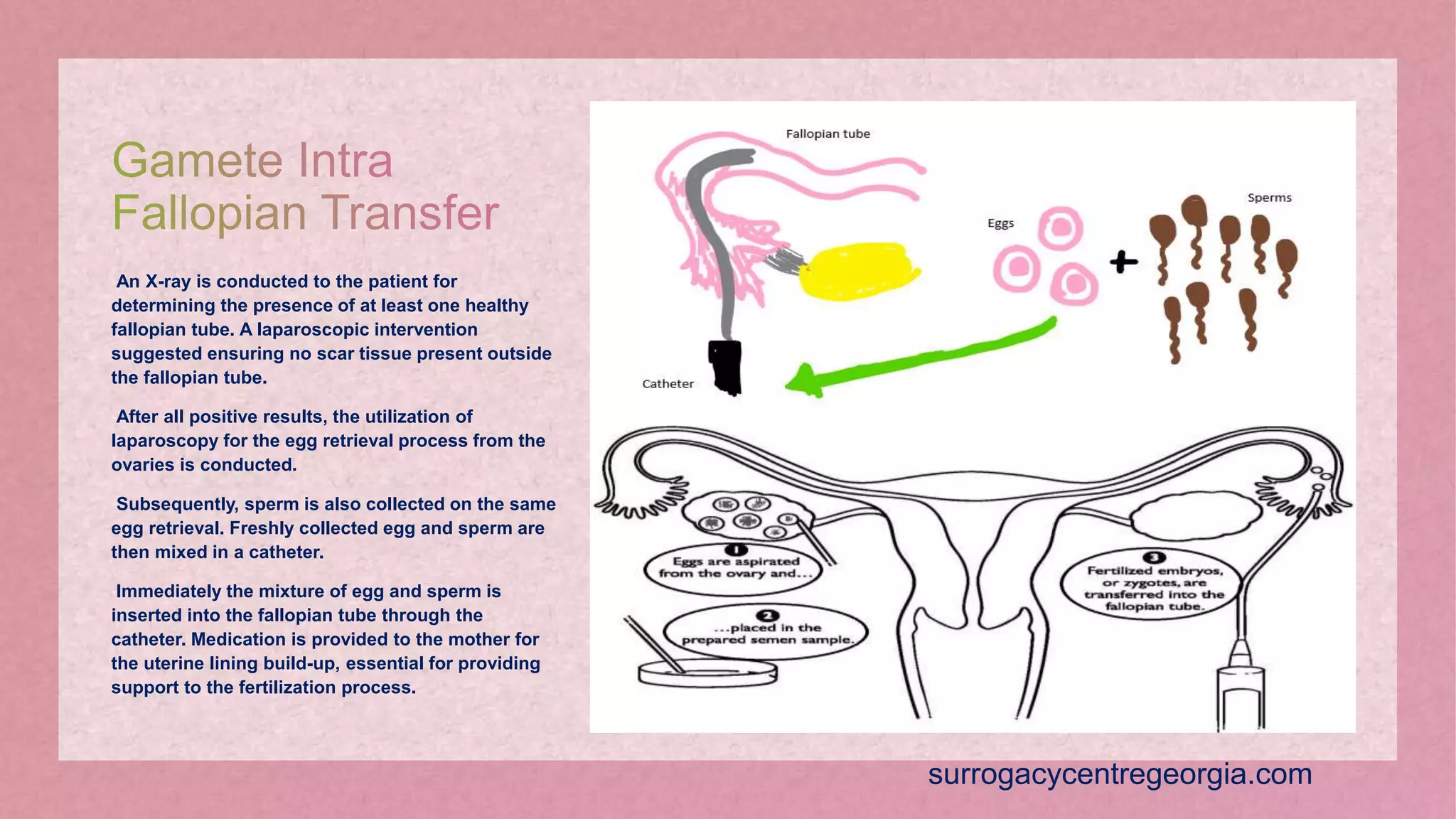 Assisted reproductive techniques | PPT