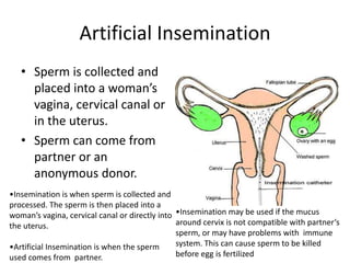 Artificial Insemination 
• Sperm is collected and 
placed into a woman’s 
vagina, cervical canal or 
in the uterus. 
• Sperm can come from 
partner or an 
anonymous donor. 
•Insemination is when sperm is collected and 
processed. The sperm is then placed into a 
woman’s vagina, cervical canal or directly into 
the uterus. 
•Insemination may be used if the mucus 
around cervix is not compatible with partner’s 
sperm, or may have problems with immune 
system. This can cause sperm to be killed 
before egg is fertilized 
•Artificial Insemination is when the sperm 
used comes from partner. 
 
