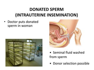 DONATED SPERM 
(INTRAUTERINE INSEMINATION) 
• Doctor puts donated 
sperm in woman 
• Seminal fluid washed 
from sperm 
• Donor selection possible 
 