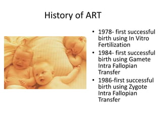 History of ART 
• 1978- first successful 
birth using In Vitro 
Fertilization 
• 1984- first successful 
birth using Gamete 
Intra Fallopian 
Transfer 
• 1986-first successful 
birth using Zygote 
Intra Fallopian 
Transfer 
 