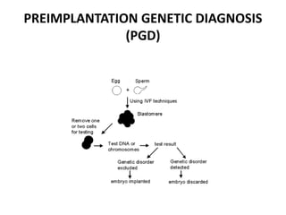 PREIMPLANTATION GENETIC DIAGNOSIS 
(PGD) 
 