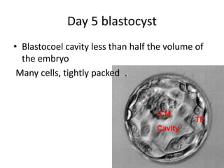 Day 5 blastocyst 
• Blastocoel cavity less than half the volume of 
the embryo 
Many cells, tightly packed 
 