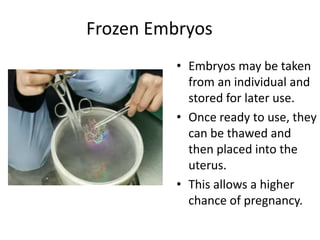 Frozen Embryos 
• Embryos may be taken 
from an individual and 
stored for later use. 
• Once ready to use, they 
can be thawed and 
then placed into the 
uterus. 
• This allows a higher 
chance of pregnancy. 
 