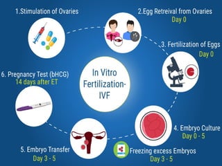 Assisted reproductive technology | PPT