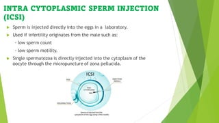 Assisted reproductive technology | PDF