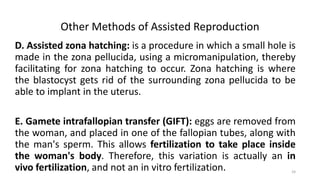 Other Methods of Assisted Reproduction
D. Assisted zona hatching: is a procedure in which a small hole is
made in the zona pellucida, using a micromanipulation, thereby
facilitating for zona hatching to occur. Zona hatching is where
the blastocyst gets rid of the surrounding zona pellucida to be
able to implant in the uterus.
E. Gamete intrafallopian transfer (GIFT): eggs are removed from
the woman, and placed in one of the fallopian tubes, along with
the man's sperm. This allows fertilization to take place inside
the woman's body. Therefore, this variation is actually an in
vivo fertilization, and not an in vitro fertilization. 24
 