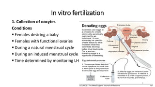 In vitro fertilization
1. Collection of oocytes
Conditions
 Females desiring a baby
 Females with functional ovaries
 During a natural menstrual cycle
 During an induced menstrual cycle
 Time determined by monitoring LH
8
 