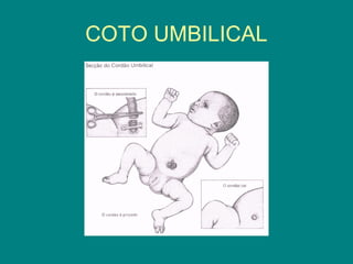 COTO UMBILICAL

 
