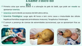  Primeira coisa que vamos avaliar é a coloração da pele do bebê, que pode ser rosado ou
apresentar icterícia.
 Icterícia ocorre devido ao excesso de bilirrubina sérica.
 Icterícia Fisiológica: surge após 48 horas e tem como causa a imaturidade das células
hepáticas/hemólise exagerada (eritroblastos imaturos). Terapêutica: Fototerapia.
 É comum a presença de cianose de extremidades (acrocianose), que se apresentam frias ao
toque.
Exame Físico do
RN
 