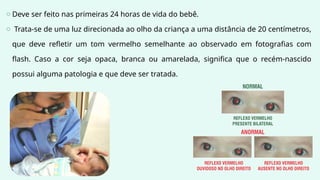 o Deve ser feito nas primeiras 24 horas de vida do bebê.
o Trata-se de uma luz direcionada ao olho da criança a uma distância de 20 centímetros,
que deve refletir um tom vermelho semelhante ao observado em fotografias com
flash. Caso a cor seja opaca, branca ou amarelada, significa que o recém-nascido
possui alguma patologia e que deve ser tratada.
 