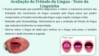 Avaliação do Frênulo da Língua - Teste da
Linguinha
 Exame padronizado que possibilita diagnosticar e indicar o tratamento precoce das
limitações dos movimentos da língua causadas pela língua presa que podem
comprometer as funções exercidas pela língua: sugar, engolir, mastigar e falar.
o Realizado pelo fonoaudiólogo. Recomenda-se que a avaliação do frênulo da língua
seja realizada inicialmente na maternidade.
o Deve-se elevar a língua do bebê para verificar se a língua está presa, e também
observar o bebê chorando e sugando.
 
