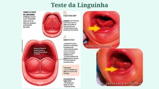 Teste da Linguinha
 