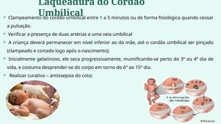  Clampeamento do cordão umbilical entre 1 a 5 minutos ou de forma fisiológica quando cessar
a pulsação.
 Verificar a presença de duas artérias e uma veia umbilical
 A criança deverá permanecer em nível inferior ao da mãe, até o cordão umbilical ser pinçado
(clampeado e cortado logo após o nascimento);
 Inicialmente gelatinoso, ele seca progressivamente, mumificando-se perto do 3º ou 4º dia de
vida, e costuma desprender-se do corpo em torno do 6º ao 15º dia.
 Realizar curativo – antissepsia do coto;
Laqueadura do Cordão
Umbilical
 