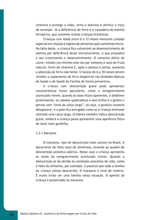 vitamina A protege a visão, evita a diarreia e diminui o risco 
de sarampo. Já a defi ciência de ferro é a causadora da anemia 
ferropriva, que acomete muitas crianças brasileiras. 
Crianças com idade entre 6 a 12 meses merecem cuidado 
especial em relação à ingesta de alimentos que contenham ferro. 
Na falta deste, a criança fi ca vulnerável ao desenvolvimento de 
anemia por defi ciência desse micronutriente, o que prejudica 
o seu crescimento e desenvolvimento. O consumo diário de 
carne, miúdos (no mínimo uma vez por semana) e suco de fruta 
natural, fonte de vitamina C, após o almoço e jantar, aumenta 
a absorção do ferro não heme. Crianças de 6 a 18 meses devem 
receber o suplemento de ferro disponível nas Unidades Básicas 
de Saúde e de Saúde da Família de forma preventiva. 
A criança com desnutrição grave pode apresentar 
características muito peculiares, como o emagrecimento 
acentuado visível, quando os ossos fi cam aparentes, o abdômen 
proeminente, os cabelos quebradiços e sem brilho e o glúteo e 
pernas com “sinal da calça larga”, ou seja, a gordura corporal 
desaparece, e a pele fi ca enrugada como se a criança estivesse 
vestindo uma calça larga. O edema também indica desnutrição 
grave, embora a criança possa apresentar uma aparência física 
de estar mais gordinha. 
3.2.1 Marasmo 
O marasmo, tipo de desnutrição mais comum no Brasil, é 
decorrente da falta total de alimentos, levando ao quadro de 
desnutrição proteico-calórica. Nesse caso a criança apresenta 
os sinais de emagrecimento acentuado visível. Quando a 
desnutrição se dá devido às condições precárias de vida, como 
a falta do alimento, por exemplo, é possível que toda a família 
da criança esteja desnutrida. O marasmo é sinal de miséria. 
É muito triste ver uma família nessa situação. O apetite da 
criança é preservado no marasmo. 
48 Módulo Optativo 8 - Assitência de Enfermagem por Ciclos de Vida 
 