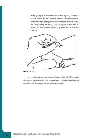 dedos polegar e indicador. Ao soltar a pele, verifi que 
se ela volta ao seu estado normal imediatamente, 
lentamente (até 2 segundos) ou muito lentamente (mais 
de 2 segundos). O tempo que leva para a pele voltar 
ao seu estado anterior indica o grau de hidratação da 
criança. 
BRASIL, 2002. 
As classifi cações estão relacionadas ao estado de hidratação 
da criança, dessa forma, veja como a AIDPI classifi ca as crianças 
com diarreia de acordo com o quadro a seguir: 
62 Módulo Optativo 8 - Assitência de Enfermagem por Ciclos de Vida 
 