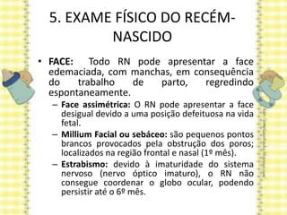 5. EXAME FÍSICO DO RECÉM-
NASCIDO
• FACE: Todo RN pode apresentar a face
edemaciada, com manchas, em consequência
do trabalho de parto, regredindo
espontaneamente.
– Face assimétrica: O RN pode apresentar a face
desigual devido a uma posição defeituosa na vida
fetal.
– Millium Facial ou sebáceo: são pequenos pontos
brancos provocados pela obstrução dos poros;
localizados na região frontal e nasal (1º mês).
– Estrabismo: devido à imaturidade do sistema
nervoso (nervo óptico imaturo), o RN não
consegue coordenar o globo ocular, podendo
persistir até o 6º mês.
 