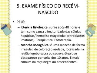 5. EXAME FÍSICO DO RECÉM-
NASCIDO
• PELE:
– Icterícia fisiológica: surge após 48 horas e
tem como causa a imaturidade das células
hepáticas/ hemólise exagerada (eritroblastos
imaturos). Terapêutica: Fototerapia.
– Mancha Mongólica: é uma mancha de forma
irregular, de coloração azulada, localizada na
região lombo-sacra ou sacro-glútea que
desaparece por volta dos 10 anos. É mais
comum na raça negra ou descendentes.
 
