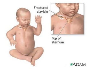 5. EXAME FÍSICO DO RECÉM-
NASCIDO
 