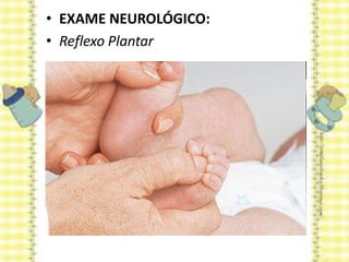 • EXAME NEUROLÓGICO:
• Reflexo Plantar
 