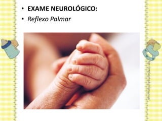 • EXAME NEUROLÓGICO:
• Reflexo Palmar
 