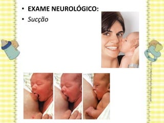 • EXAME NEUROLÓGICO:
• Sucção
 