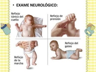 • EXAME NEUROLÓGICO:
 