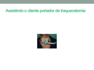 Assistindo o cliente portador de traqueostomia
 