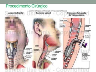 Procedimento Cirúrgico
 