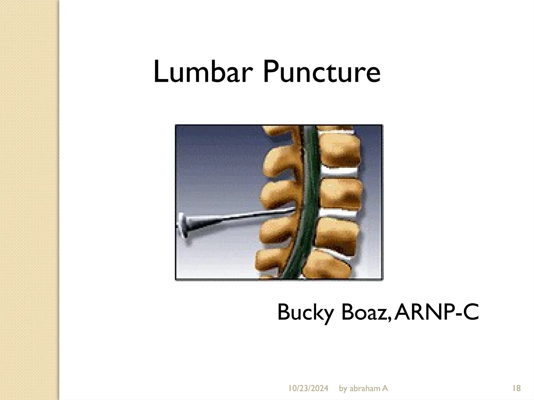10/23/2024 by abraham A
Lumbar Puncture
Bucky Boaz,ARNP-C
18
 