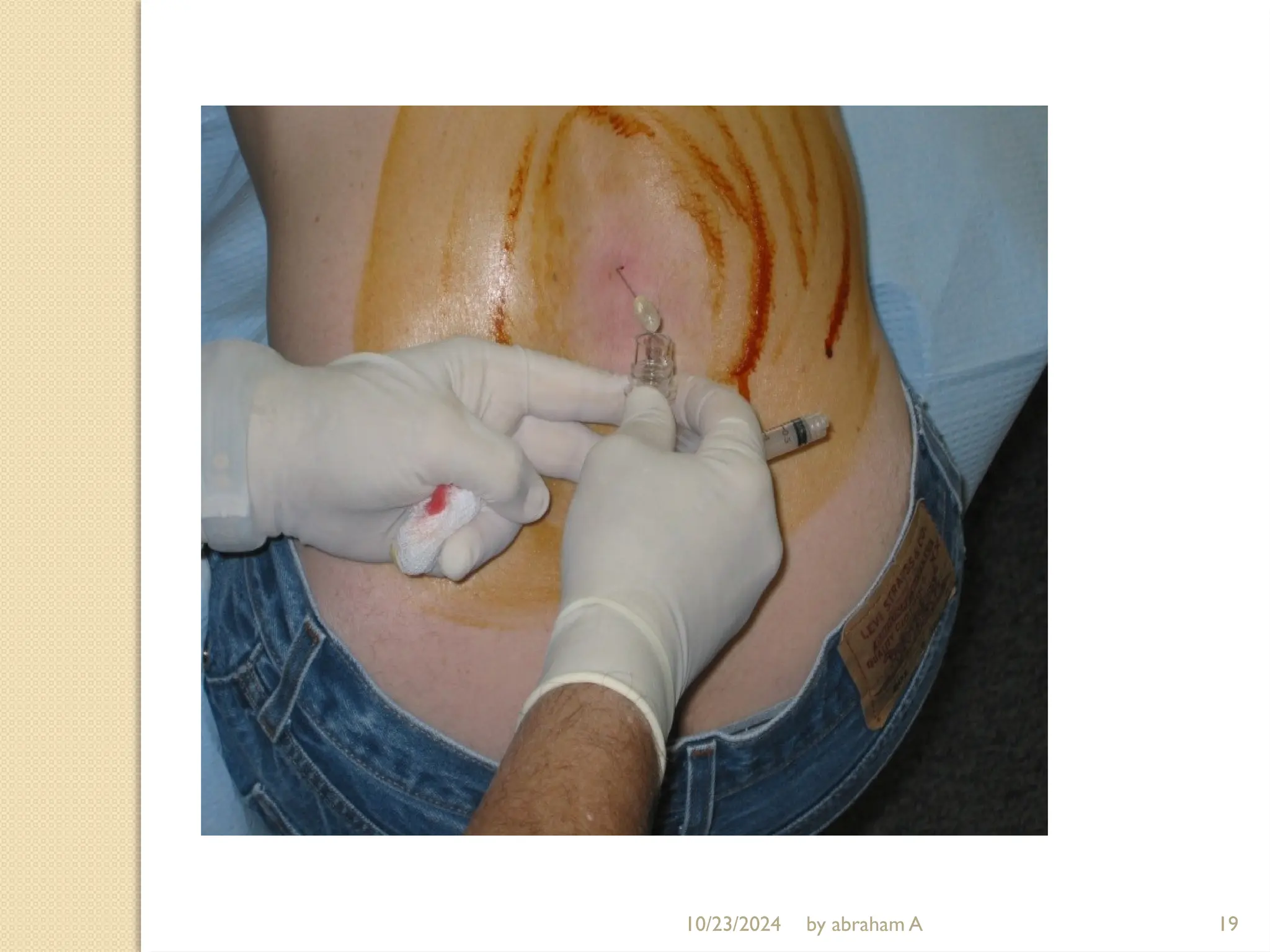 10/23/2024 by abraham A 19
 