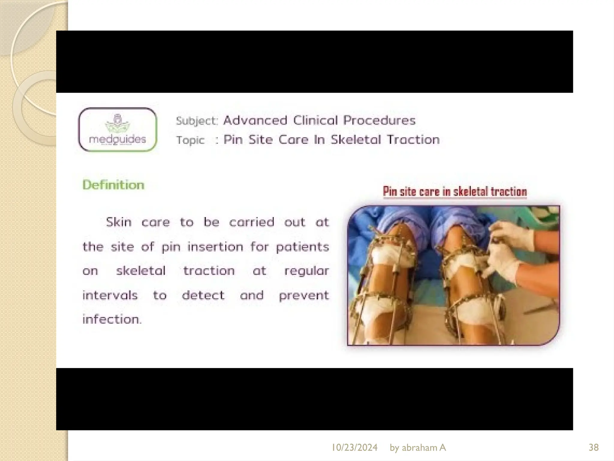 10/23/2024 by abraham A 38
 