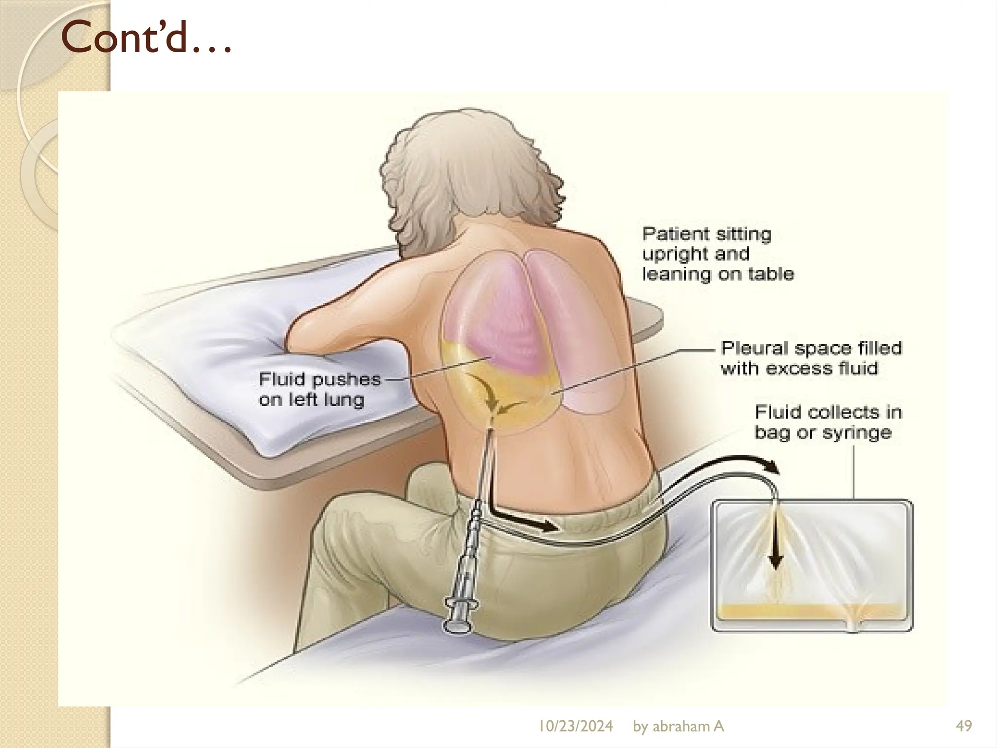 10/23/2024 by abraham A 49
Cont’d…
 