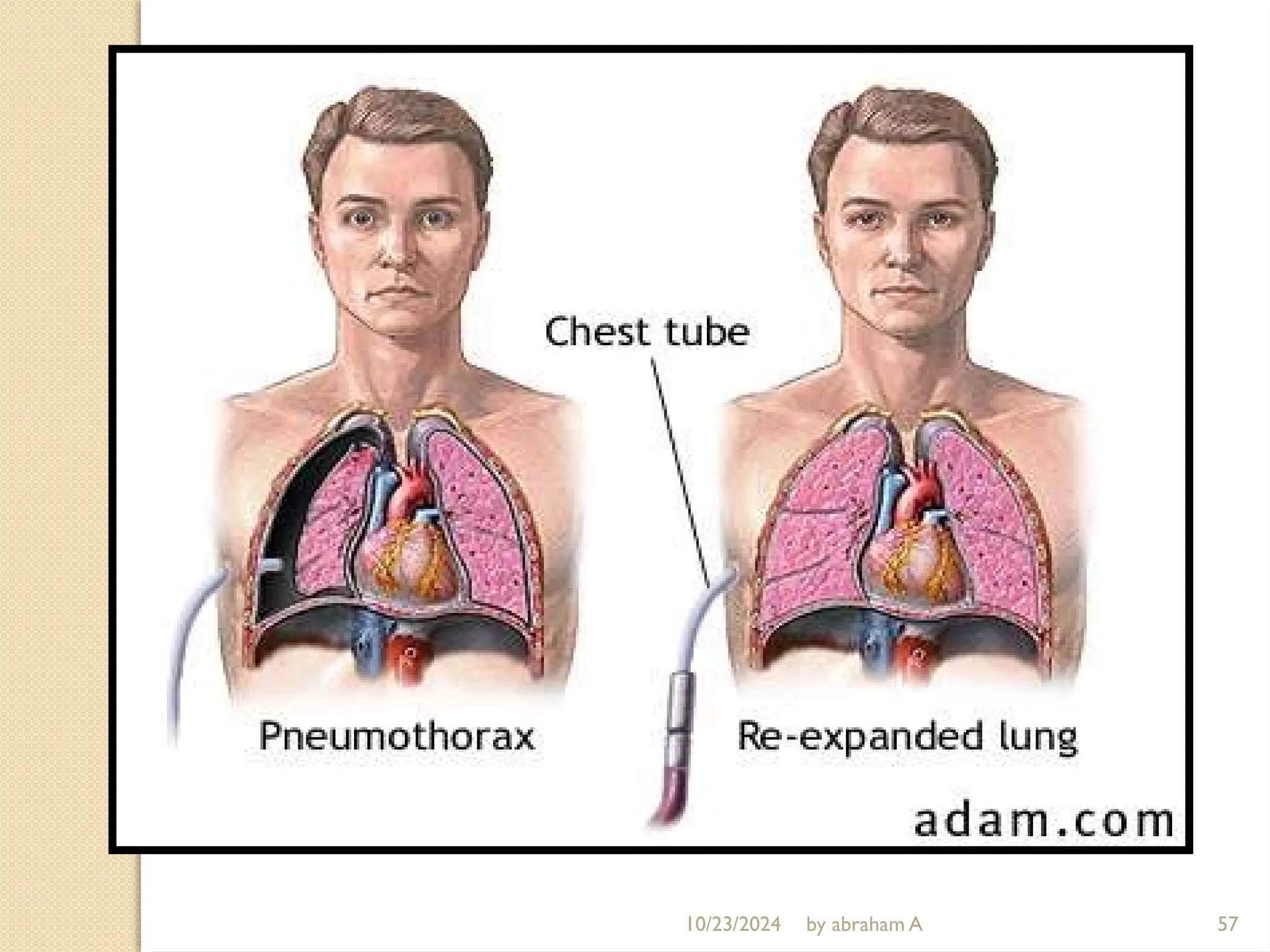 10/23/2024 by abraham A 57
 