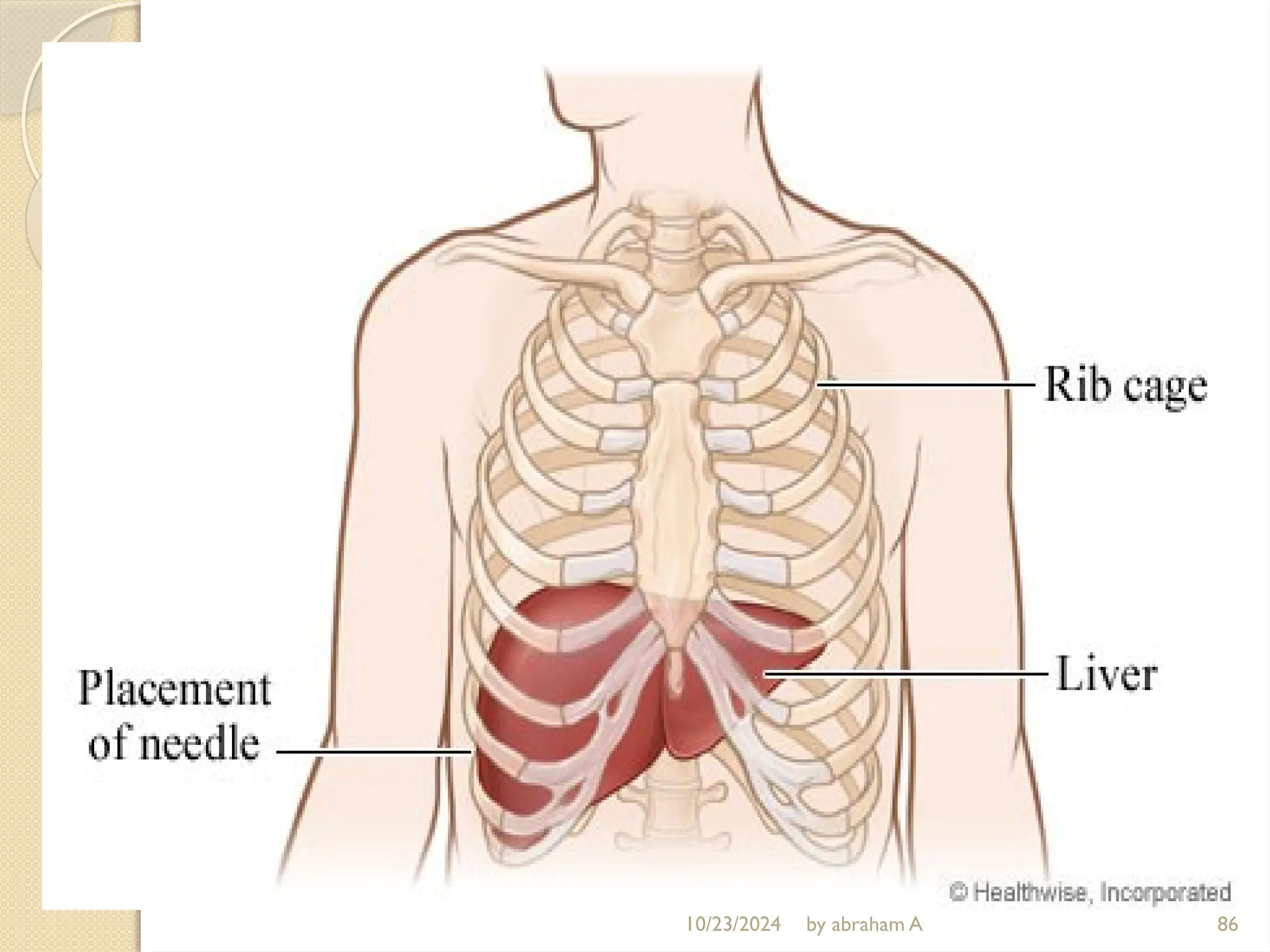10/23/2024 by abraham A 86
 